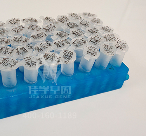 【佳学基因-基因检测】科学家成功精确定位糖尿病基因，根治糖尿病已不是梦想！​