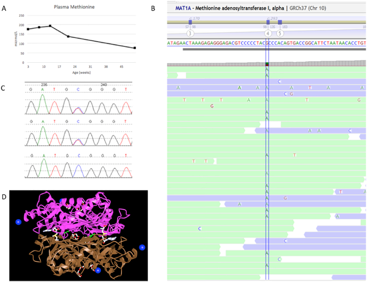 【佳学基因检测】高蛋氨酸血症基因检测案例