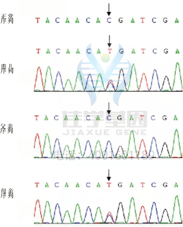【基因检测基因解码案例】吉特尔曼（Gitelman）综合症——佳学基因