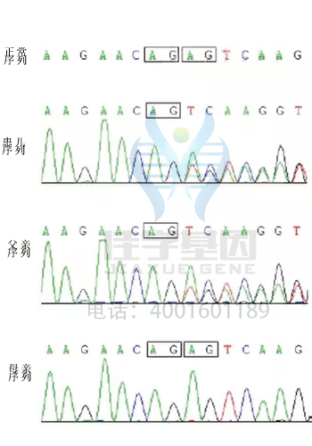 【基因检测基因解码案例】吉特尔曼（Gitelman）综合症——佳学基因