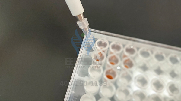 【佳学基因-基因检测】时而狂躁不安,时而抑郁低落,要小心是双向情感障碍 【佳学基因-基因检测】时而狂躁不安,时而抑郁低落,要小心是双向情感障碍