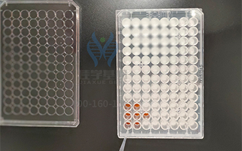 【佳学基因解码-基因检测】富贵天注定——还真存在“富贵基因”? 【佳学基因解码-基因检测】富贵天注定——还真存在“富贵基因”?